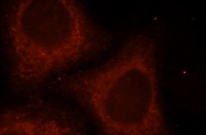 Immunofluorescent analysis of HepG2 cells, using UGT2B4 antibody Catalog No:116558 at 1:25 dilution and Rhodamine-labeled goat anti-rabbit IgG (red).