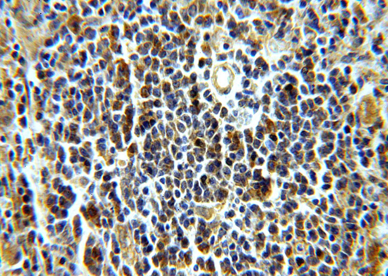 Immunohistochemical of paraffin-embedded human spleen using Catalog No:112319(LRMP antibody) at dilution of 1:100 (under 40x lens)