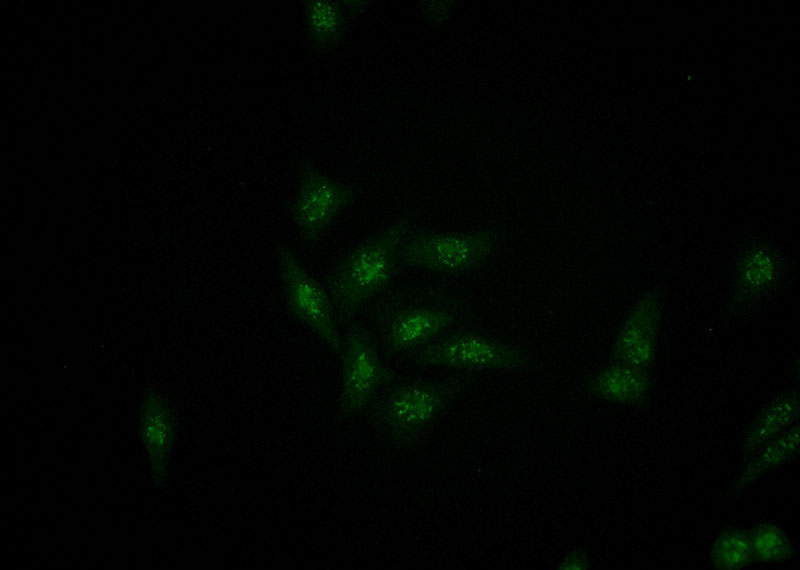 Immunofluorescent analysis of HeLa cells using Catalog No:114927(RRP1 Antibody) at dilution of 1:50 and Alexa Fluor 488-congugated AffiniPure Goat Anti-Rabbit IgG(H+L)