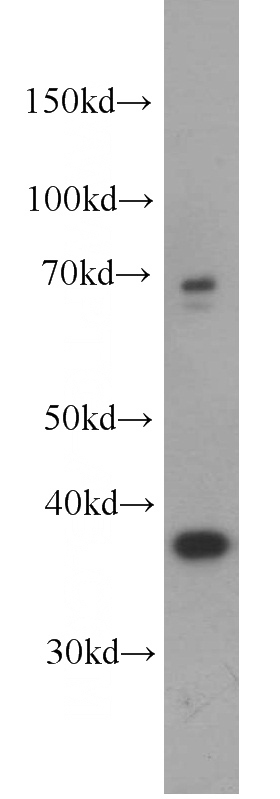 HeLa cells were subjected to SDS PAGE followed by western blot with Catalog No:110844(GALM antibody) at dilution of 1:600