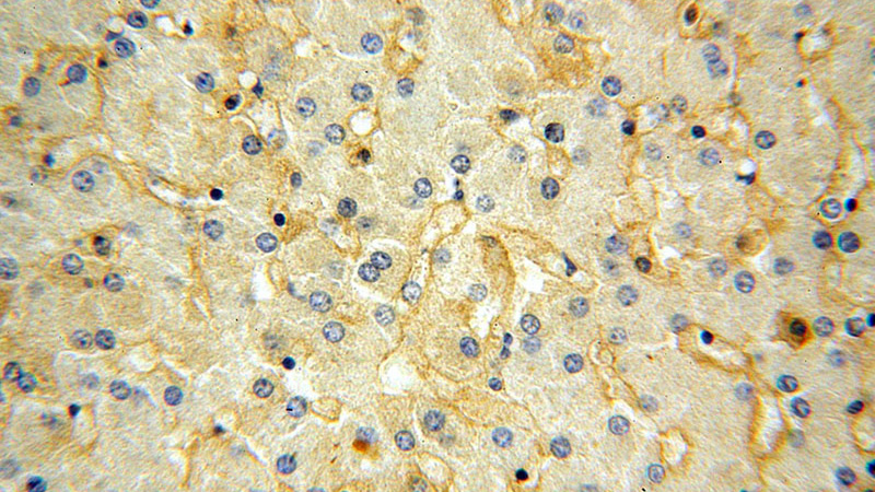 Immunohistochemical of paraffin-embedded human liver using Catalog No:111969(KCNJ15 antibody) at dilution of 1:100 (under 40x lens)