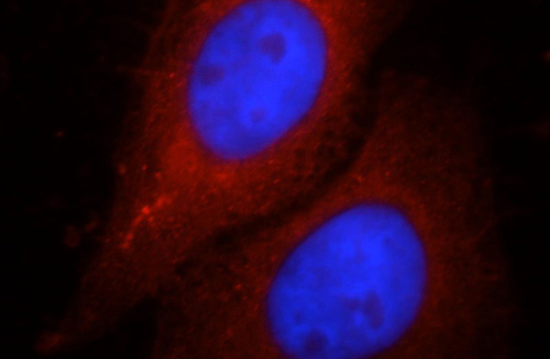 Immunofluorescent analysis of HepG2 cells, using GTSE1 antibody Catalog No:111247 at 1:25 dilution and Rhodamine-labeled goat anti-rabbit IgG (red). Blue pseudocolor = DAPI (fluorescent DNA dye).