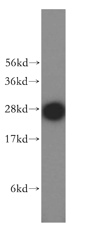 HeLa cells were subjected to SDS PAGE followed by western blot with Catalog No:115457(SNRPA1 antibody) at dilution of 1:500