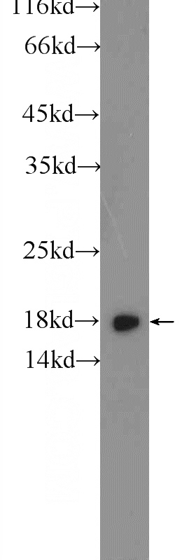 SH-SY5Y cells were subjected to SDS PAGE followed by western blot with Catalog No:114835(RPS24 Antibody) at dilution of 1:300