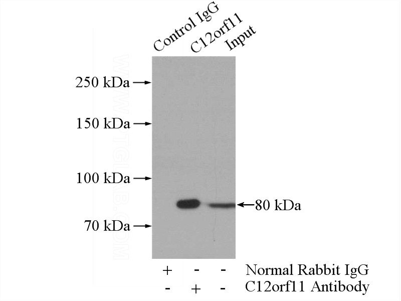 IP Result of anti-C12orf11 (IP:Catalog No:108274, 4ug; Detection:Catalog No:108274 1:4000) with MCF-7 cells lysate 1040ug.