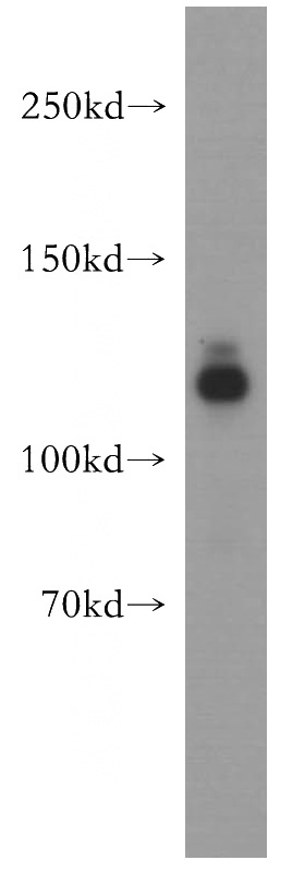 A431 cells were subjected to SDS PAGE followed by western blot with Catalog No:113619(CDH3 antibody) at dilution of 1:400