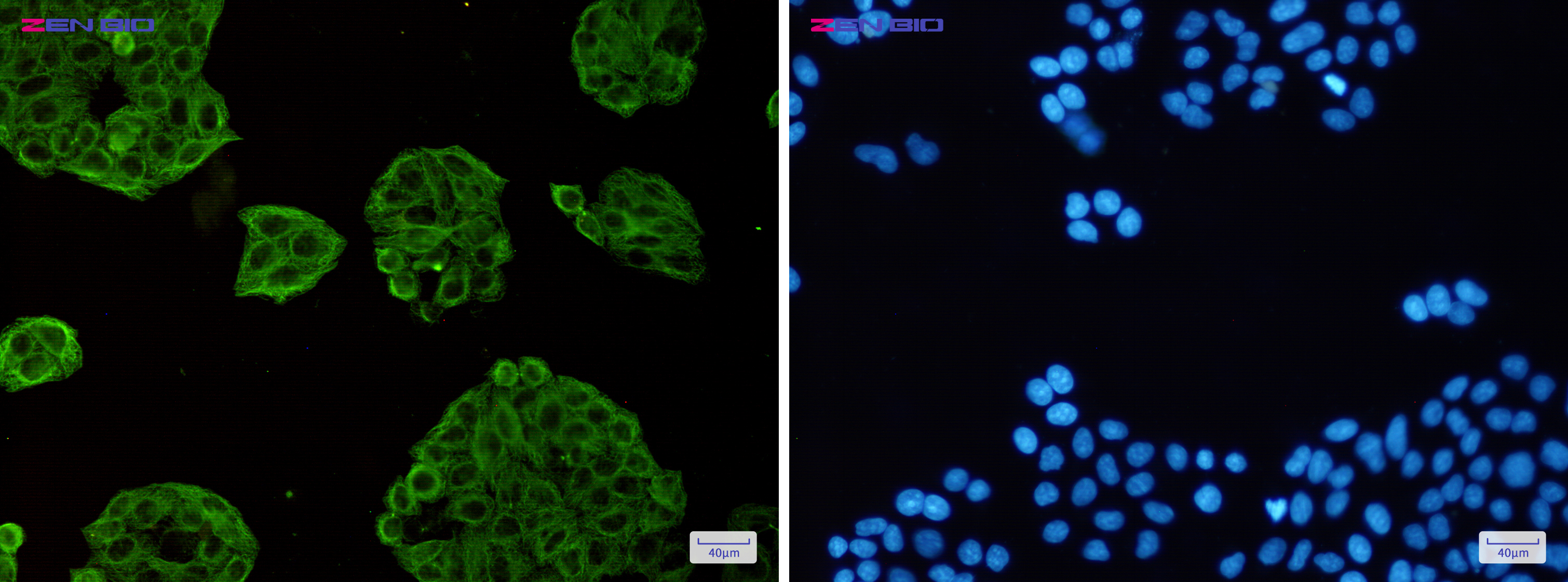 Immunocytochemistry of VPS4a(green) in Hela cells using VPS4a Rabbit pAb at dilution 1/50, and DAPI(blue)
