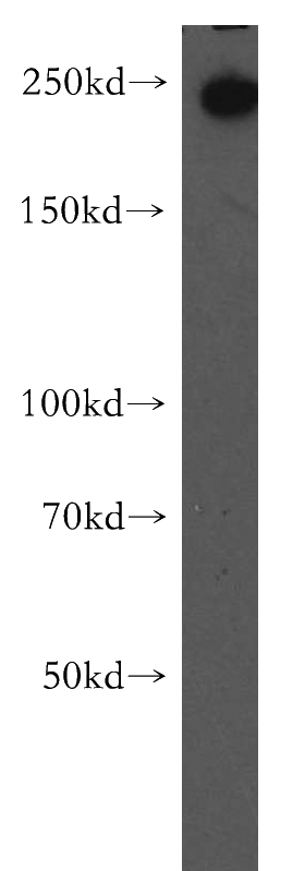 A549 cells were subjected to SDS PAGE followed by western blot with Catalog No:112991(MYOF antibody) at dilution of 1:300