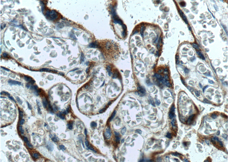 Immunohistochemistry of paraffin-embedded human placenta tissue slide using Catalog No:116074(TLR4 Antibody) at dilution of 1:200 (under 40x lens).