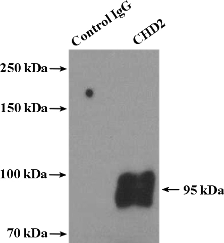 IP Result of anti-CHD2 (IP:Catalog No:109218, 4ug; Detection:Catalog No:109218 1:300) with human placenta tissue lysate 4000ug.