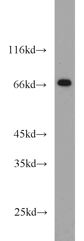 PC-3 cells were subjected to SDS PAGE followed by western blot with Catalog No:115672(STAM antibody) at dilution of 1:300