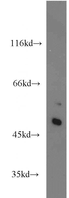 mouse liver tissue were subjected to SDS PAGE followed by western blot with Catalog No:115273(SHH antibody) at dilution of 1:800