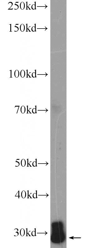 K-562 cells were subjected to SDS PAGE followed by western blot with Catalog No:114375(PSMA4 Antibody) at dilution of 1:1000