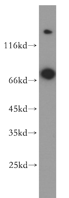 human placenta tissue were subjected to SDS PAGE followed by western blot with Catalog No:111249(GUCY1B3 antibody) at dilution of 1:500