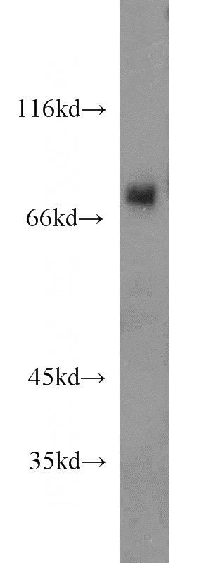 mouse brain tissue were subjected to SDS PAGE followed by western blot with Catalog No:115881(TBR1 antibody) at dilution of 1:1500