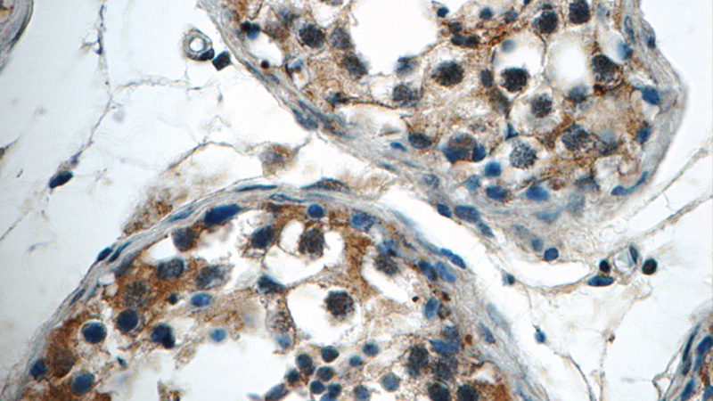 Immunohistochemistry of paraffin-embedded human testis tissue slide using Catalog No:115549(SPATA16 Antibody) at dilution of 1:50 (under 40x lens)
