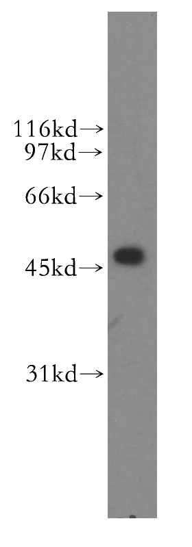 COLO 320 cells were subjected to SDS PAGE followed by western blot with Catalog No:110607(SQS antibody) at dilution of 1:500