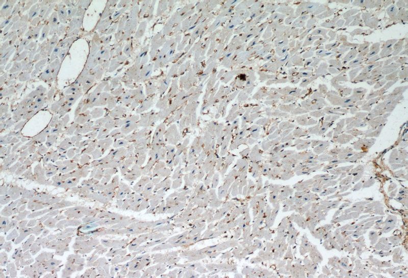 Immunohistochemistry of paraffin-embedded human heart slide using Catalog No:109723(CTGF Antibody) at dilution of 1:50