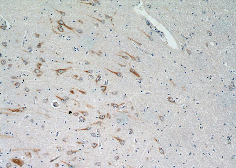 Immunohistochemistry of paraffin-embedded human brain tissue slide using Catalog No:111713(HTR6 Antibody) at dilution of 1:100 (under 10x lens).