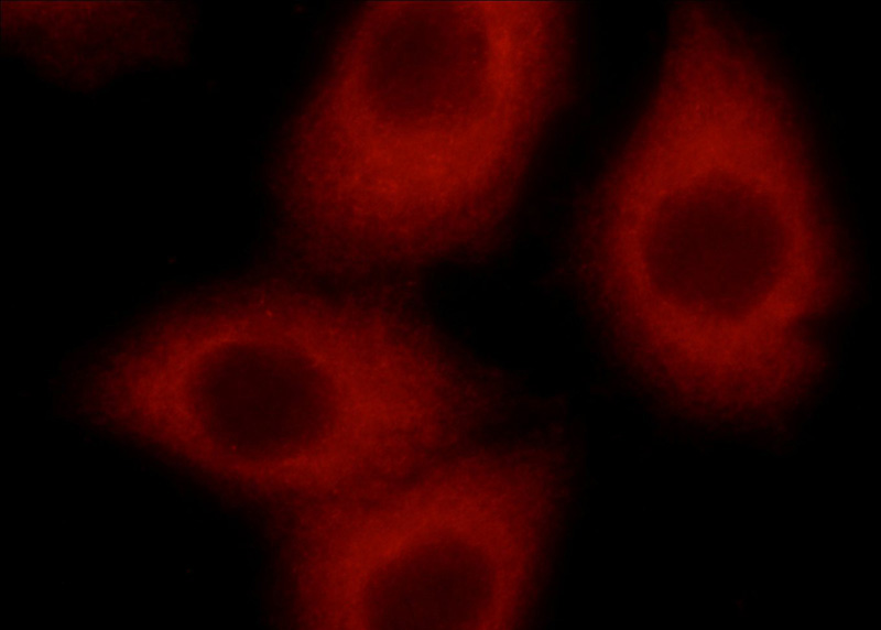 Immunofluorescent analysis of HepG2 cells using Catalog No:115683(ABRA Antibody) at dilution of 1:50 and Rhodamine-labeled goat anti-rabbit IgG (red).