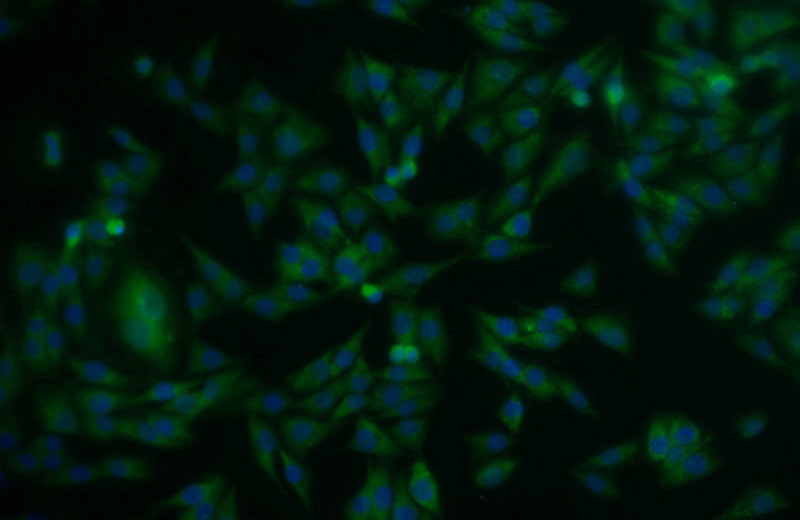 Immunofluorescent analysis of A375 cells using Catalog No:115648(SPRY2 Antibody) at dilution of 1:25 and Alexa Fluor 488-congugated AffiniPure Goat Anti-Rabbit IgG(H+L)