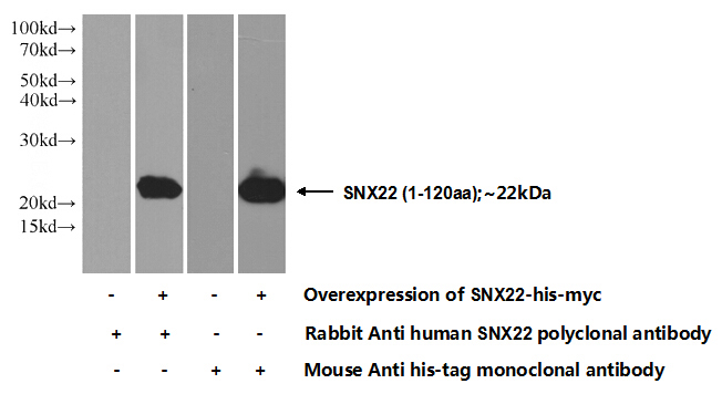Transfected HEK-293 cells were subjected to SDS PAGE followed by western blot with Catalog No:115477(SNX22 Antibody) at dilution of 1:1000