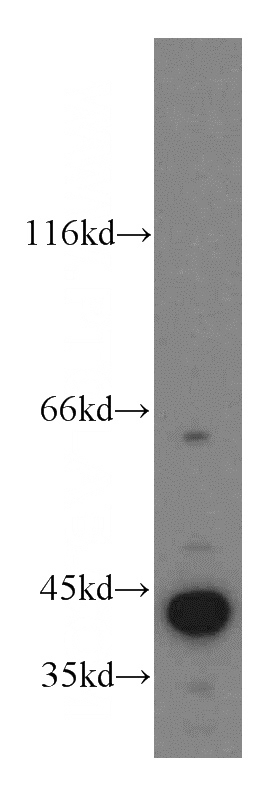 human heart tissue were subjected to SDS PAGE followed by western blot with Catalog No:112432(MAPK12 antibody) at dilution of 1:500