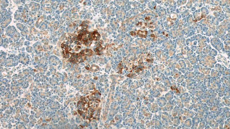 Immunohistochemical of paraffin-embedded human pancreas using Catalog No:114805(RPGRIP1L antibody) at dilution of 1:50 (under 10x lens)