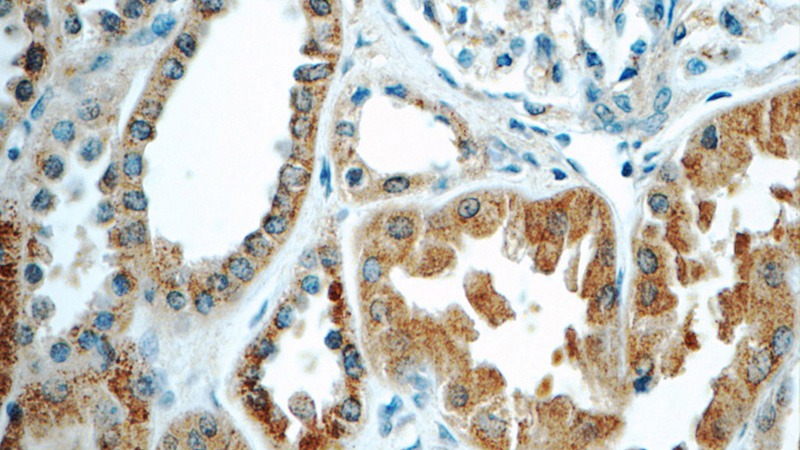 Immunohistochemistry of paraffin-embedded human kidney tissue slide using Catalog No:116025(TGFBRAP1 Antibody) at dilution of 1:50 (under 40x lens)