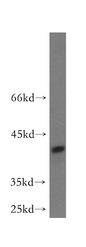 human brain tissue were subjected to SDS PAGE followed by western blot with Catalog No:111519(HOMER3 antibody) at dilution of 1:500