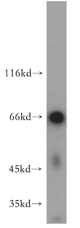 human skeletal muscle tissue were subjected to SDS PAGE followed by western blot with Catalog No:108652(C13orf18 antibody) at dilution of 1:500