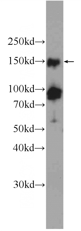 Jurkat cells were subjected to SDS PAGE followed by western blot with Catalog No:113811(PHF2 Antibody) at dilution of 1:300