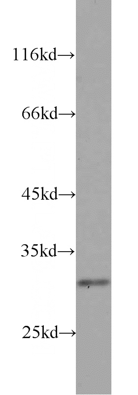 DU 145 cells were subjected to SDS PAGE followed by western blot with Catalog No:114909(RPS4Y1 antibody) at dilution of 1:1000