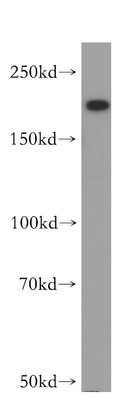 A549 cells were subjected to SDS PAGE followed by western blot with Catalog No:110048(DocK9 antibody) at dilution of 1:500