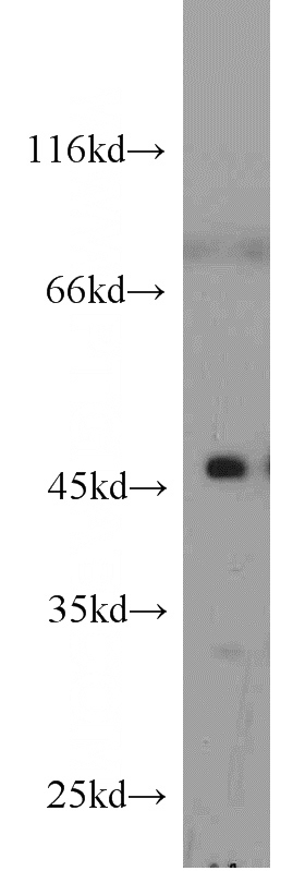 mouse heart tissue were subjected to SDS PAGE followed by western blot with Catalog No:109788(CYTH2 antibody) at dilution of 1:1000