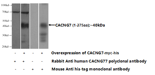 Transfected HEK-293 cells were subjected to SDS PAGE followed by western blot with Catalog No:108769(CACNG7 Antibody) at dilution of 1:1000