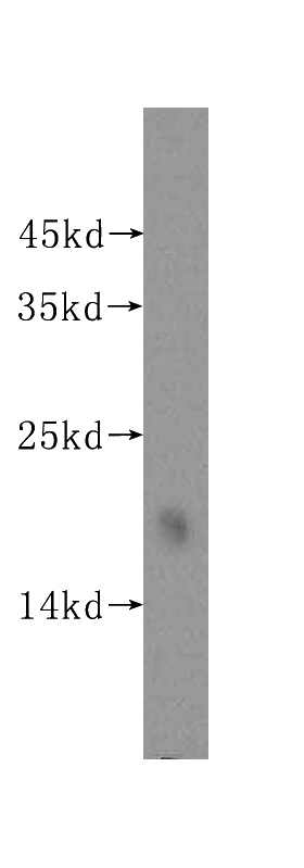 human heart tissue were subjected to SDS PAGE followed by western blot with Catalog No:112545(MCEE antibody) at dilution of 1:400