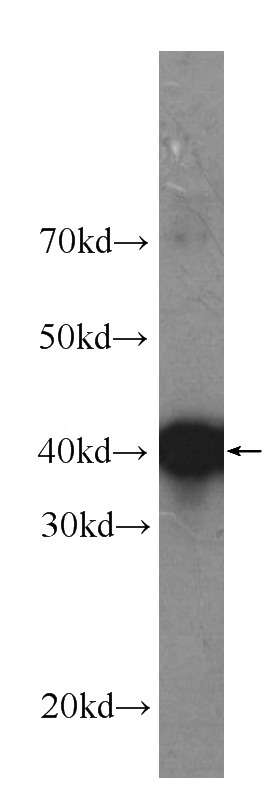 Recombinant protein were subjected to SDS PAGE followed by western blot with Catalog No:107572(ALK,CD246 Antibody) at dilution of 1:1000