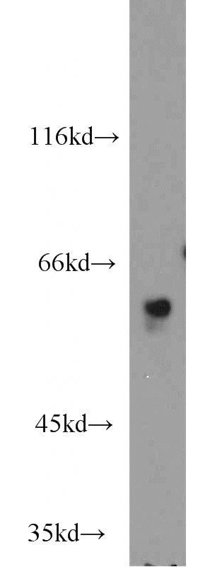 mouse thymus tissue were subjected to SDS PAGE followed by western blot with Catalog No:114574(RCBTB2 antibody) at dilution of 1:1000