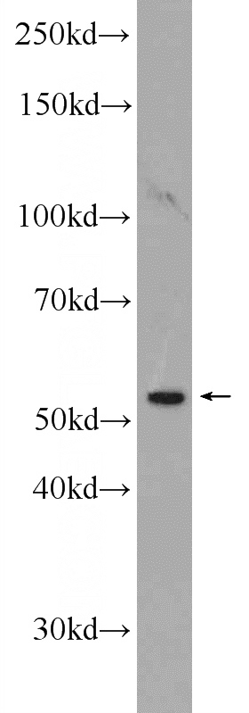 PC-3 cells were subjected to SDS PAGE followed by western blot with Catalog No:113284(NSBP1 Antibody) at dilution of 1:600
