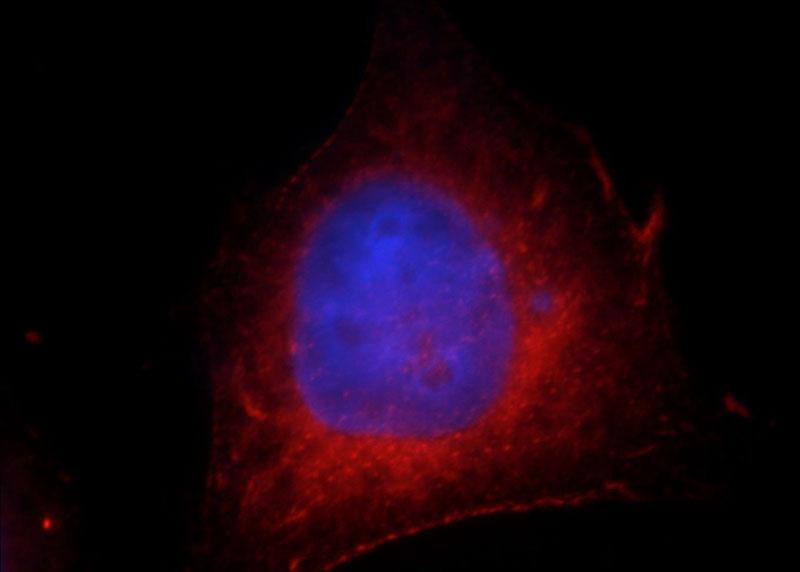 Immunofluorescent analysis of HepG2 cells, using FAM119A antibody Catalog No:110464 at 1:25 dilution and Rhodamine-labeled goat anti-rabbit IgG (red). Blue pseudocolor = DAPI (fluorescent DNA dye).