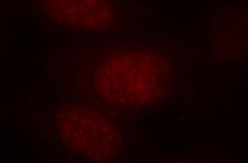 Immunofluorescent analysis of HepG2 cells, using BATF antibody Catalog No:108362 at 1:25 dilution and Rhodamine-labeled goat anti-rabbit IgG (red).