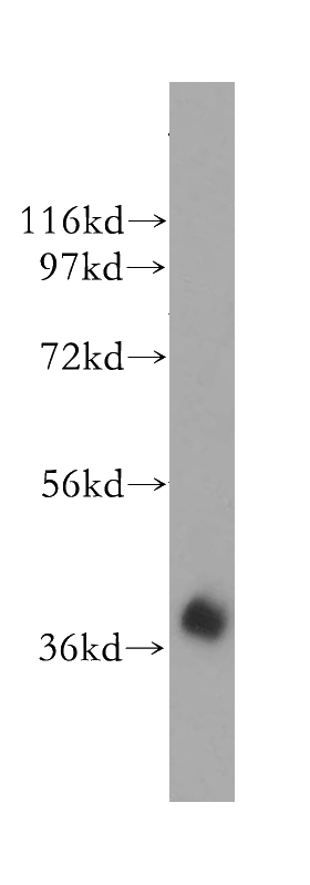 human brain tissue were subjected to SDS PAGE followed by western blot with Catalog No:111341(HIBCH antibody) at dilution of 1:500