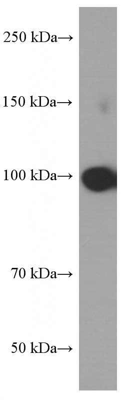 NIH/3T3 cells were subjected to SDS PAGE followed by western blot with (CTNNA1 Antibody) at dilution of 1:1000