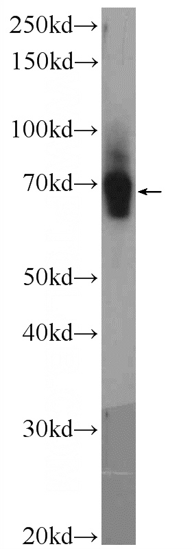 mouse colon tissue were subjected to SDS PAGE followed by western blot with Catalog No:116617(UNC5CL Antibody) at dilution of 1:300