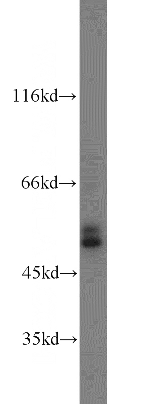 mouse brain tissue were subjected to SDS PAGE followed by western blot with Catalog No:108852(CPE antibody) at dilution of 1:600