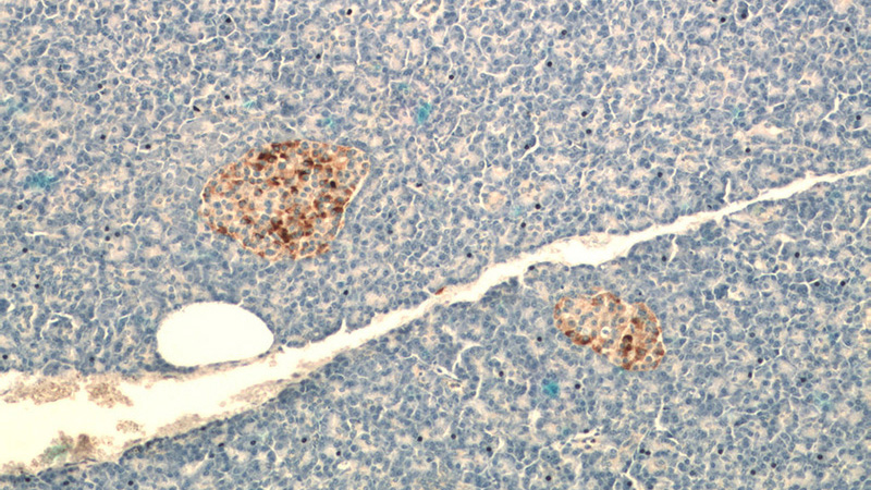 Immunohistochemistry of paraffin-embedded human pancreas tissue slide using Catalog No:109289(CHGB Antibody) at dilution of 1:200 (under 10x lens)