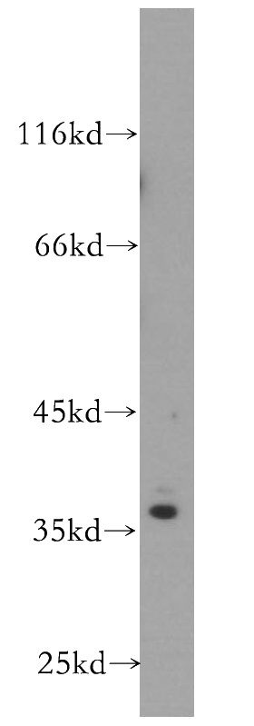 A431 cells were subjected to SDS PAGE followed by western blot with Catalog No:115661(SRA1 antibody) at dilution of 1:600