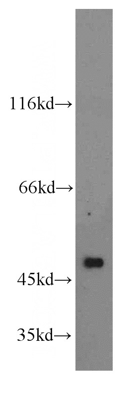mouse kidney tissue were subjected to SDS PAGE followed by western blot with Catalog No:114478(RASGRP2 antibody) at dilution of 1:300