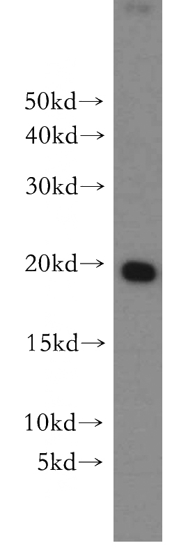 MCF7 cells were subjected to SDS PAGE followed by western blot with Catalog No:112743(MPHOSPH6 antibody) at dilution of 1:300